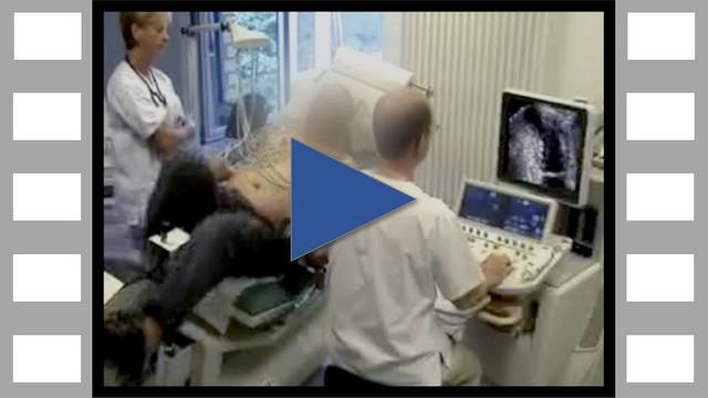 ECG sous effort sur table